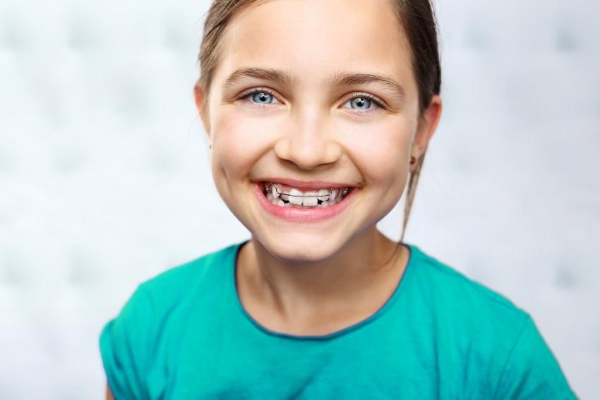 Jak dbać o higienę jamy ustnej z aparatem ortodontycznym? [fot. Adobe Stock]