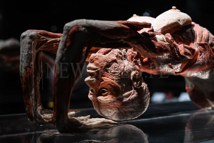 Wystawa Body Worlds w Gdańsku