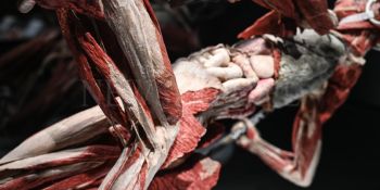 Wystawa Body Worlds w Gdańsku