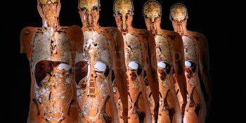 Wystawa Body Worlds w Gdańsku