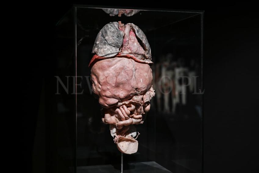 Wystawa Body Worlds w Gdańsku